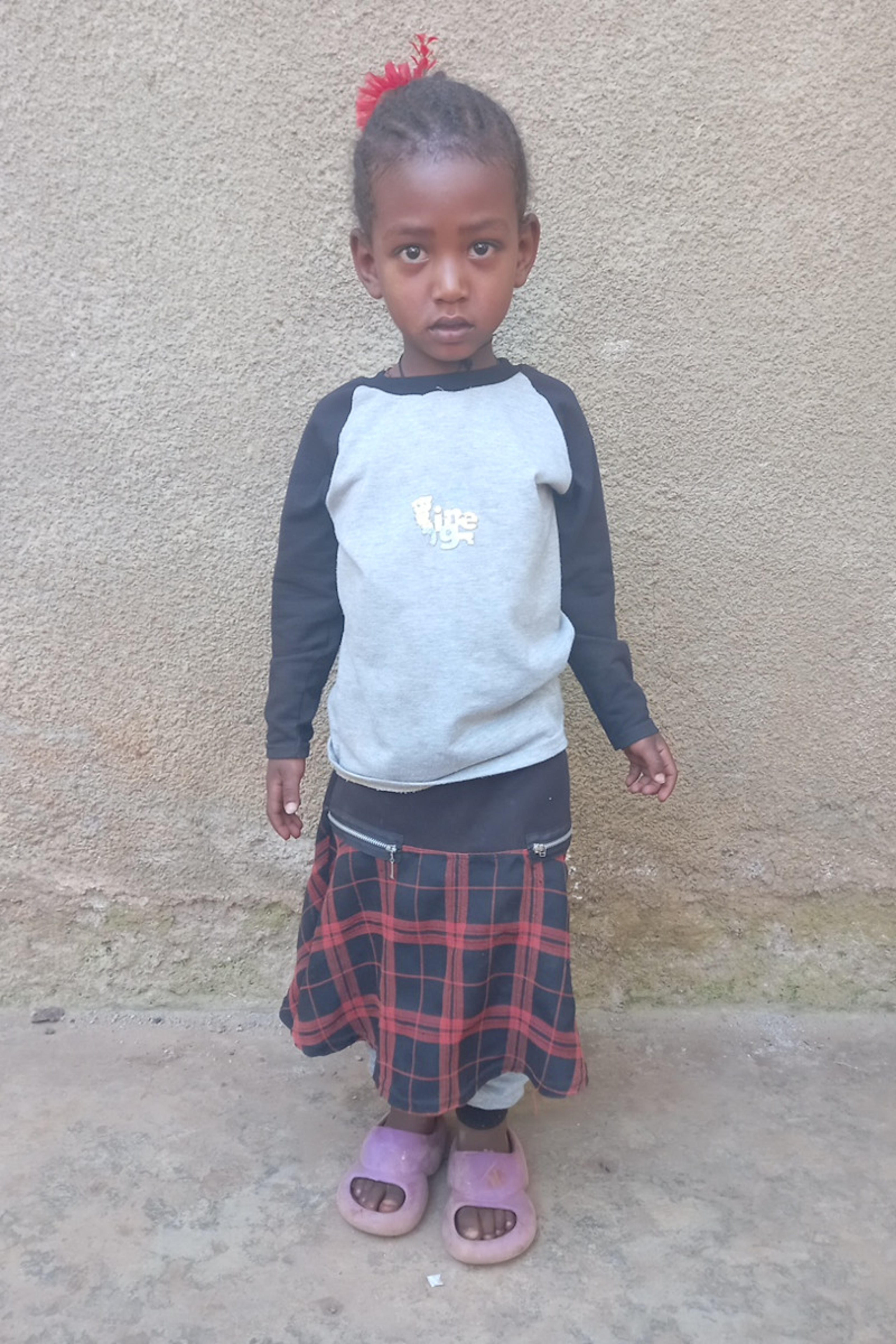 An unsponsored girl named Sinbone from Ethiopia who lives in an AIDS-affected area, is vulnerable to exploitation and has waited 331 days for a sponsor.