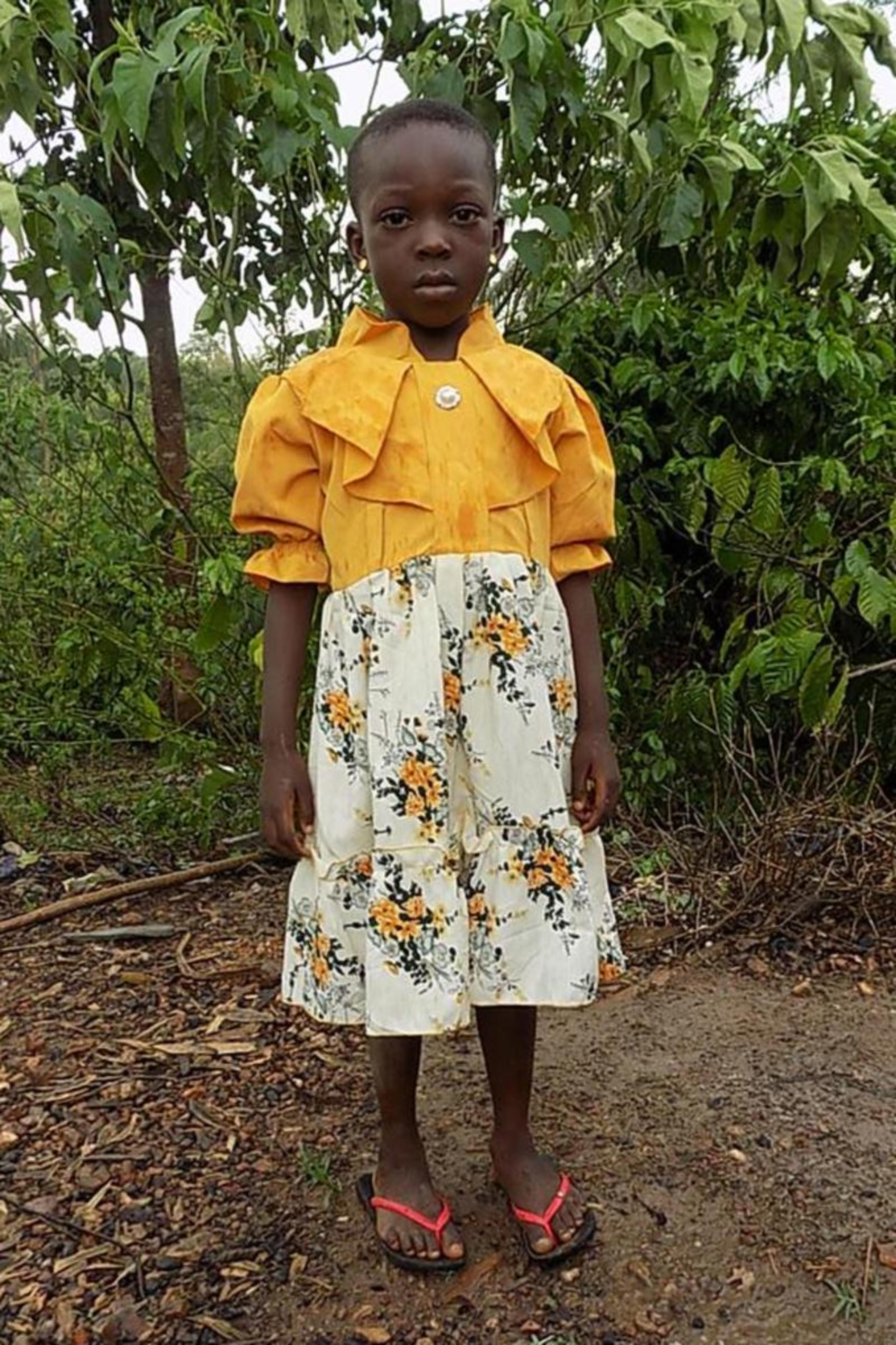 An unsponsored girl named Dovene from Togo who lives in an AIDS-affected area, is vulnerable to exploitation and has waited 532 days for a sponsor.