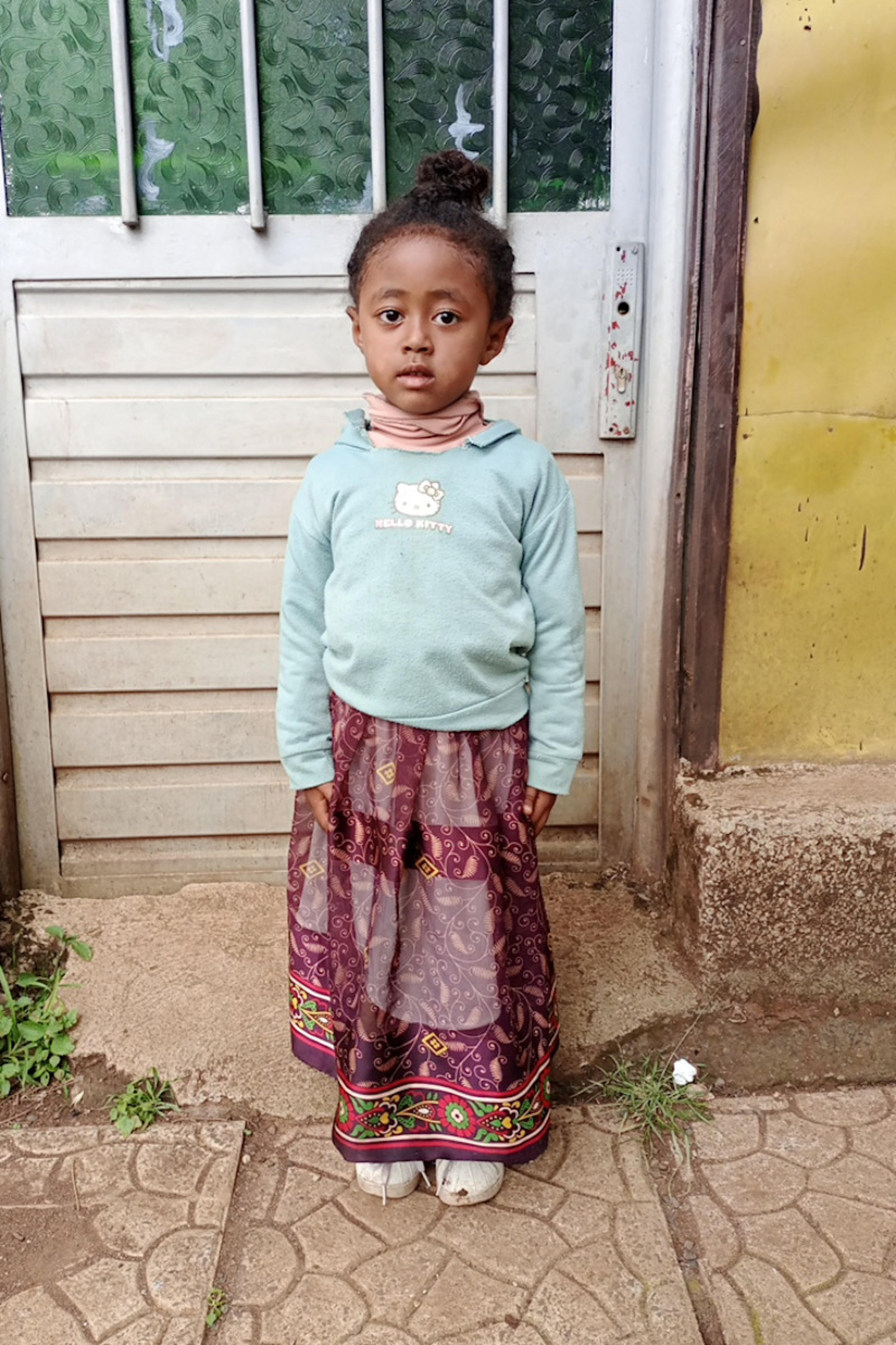 An unsponsored girl named Melon from Ethiopia who lives in an AIDS-affected area, is vulnerable to exploitation and has waited 482 days for a sponsor.