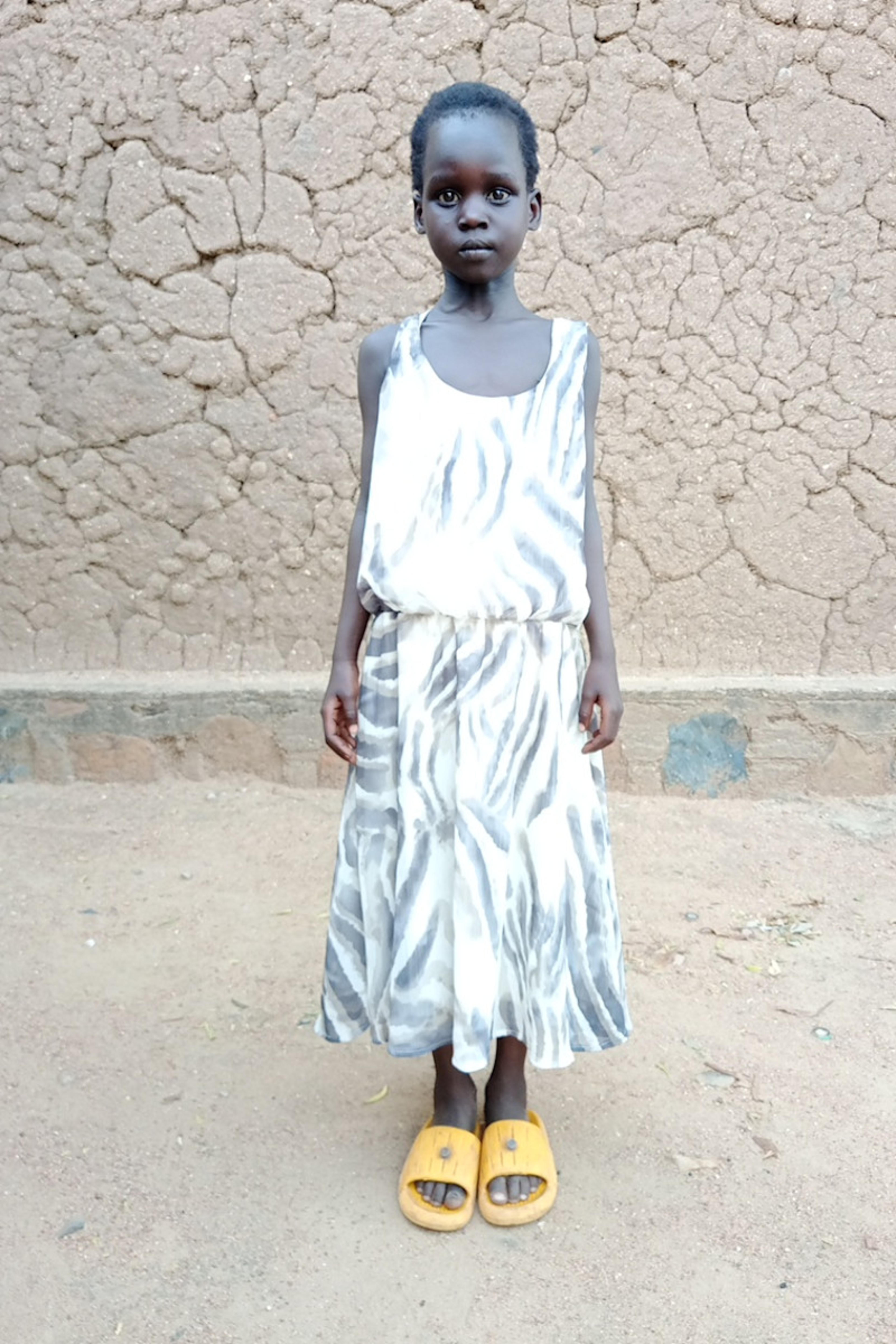 An unsponsored girl named Nyanchoik from Ethiopia who lives in an AIDS-affected area, is vulnerable to exploitation and has waited 481 days for a sponsor.