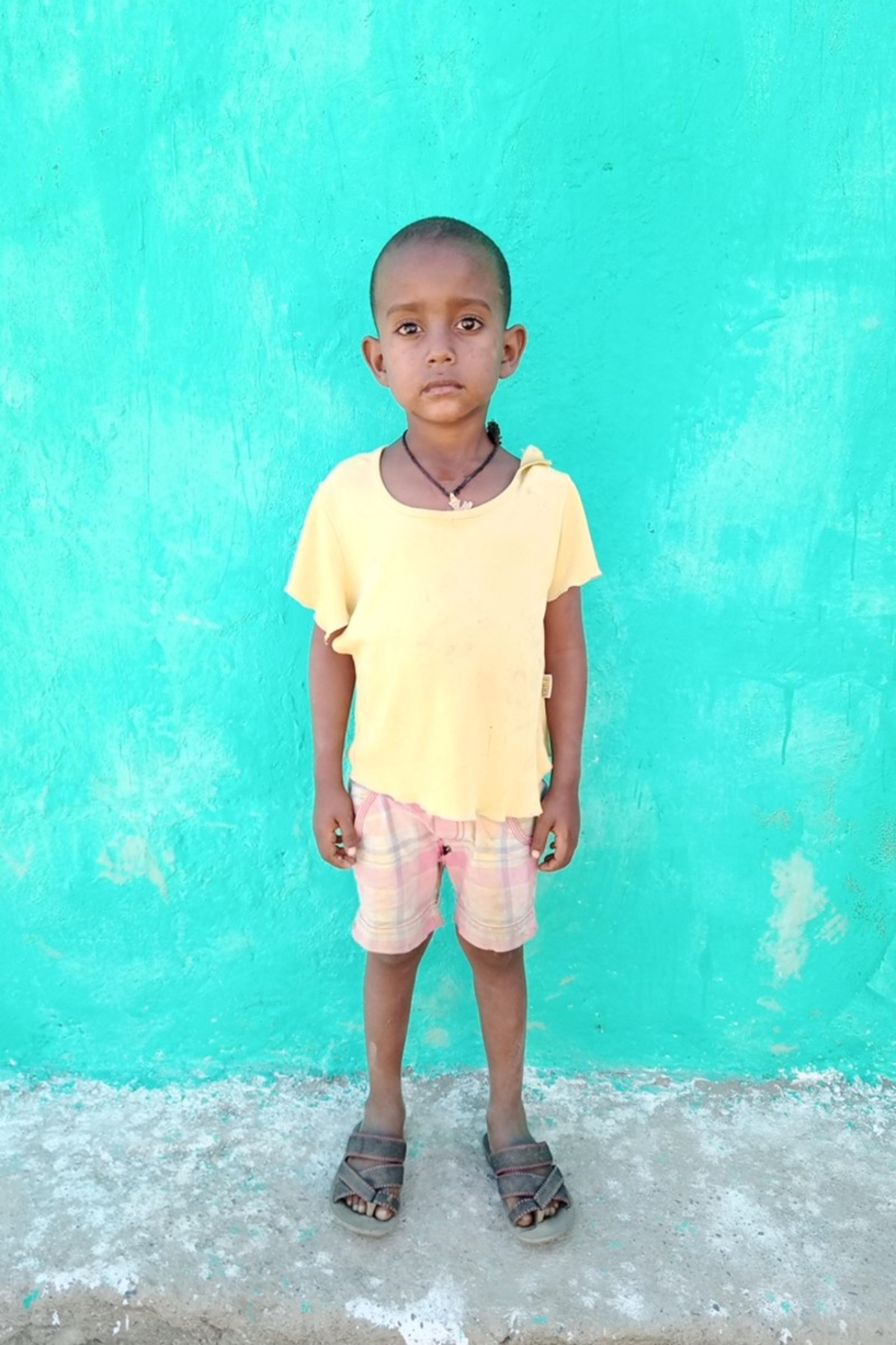 An unsponsored boy named Adoniyas from Ethiopia who lives in an AIDS-affected area, is vulnerable to exploitation and has waited 205 days for a sponsor.