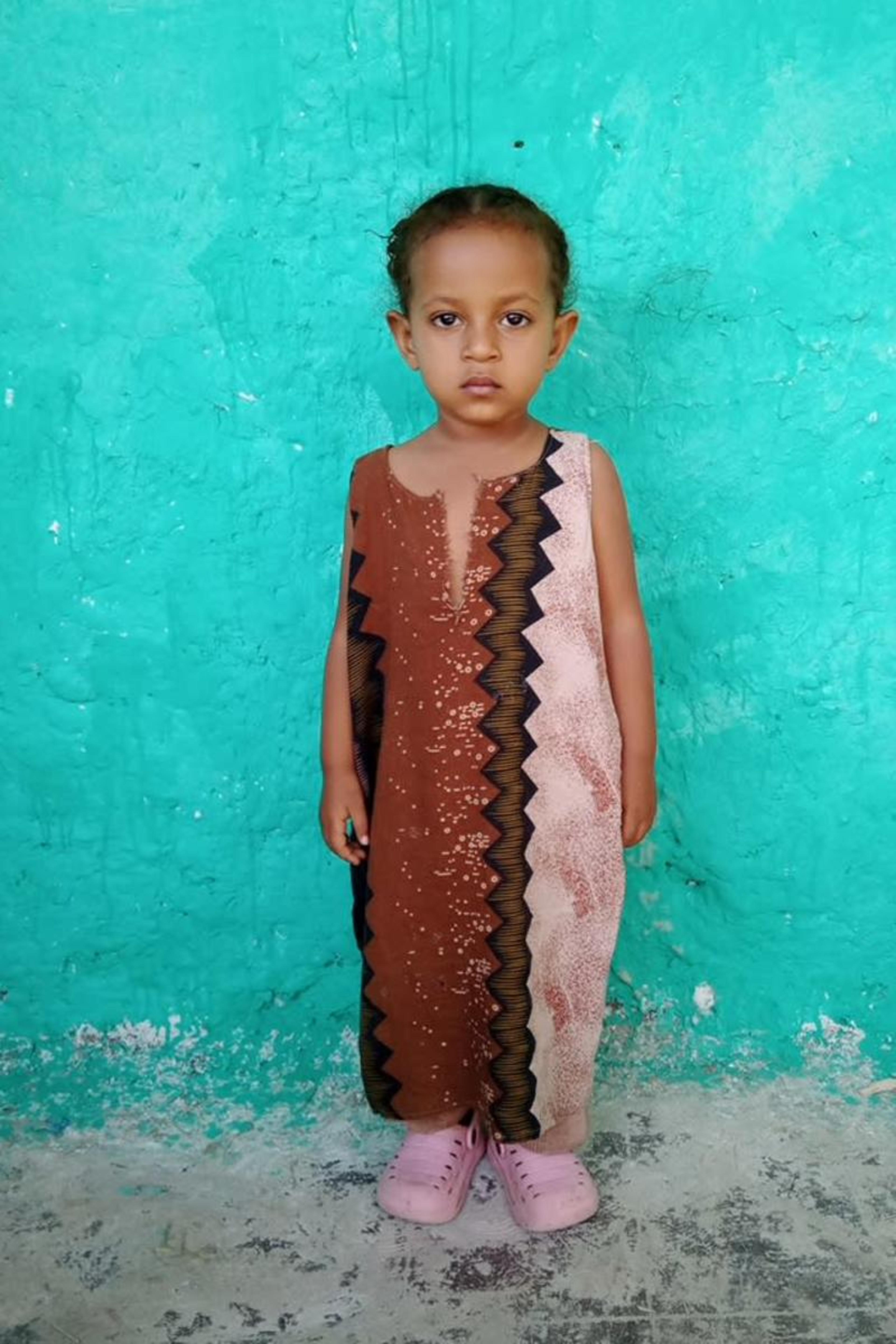 An unsponsored girl named Tumim from Ethiopia who lives in an AIDS-affected area, is vulnerable to exploitation and has waited 203 days for a sponsor.