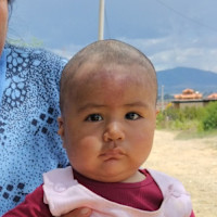 Adozione a distanza: Abigail (Bolivia)